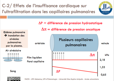 Diapo 52 Insuffisance cardiaque.png