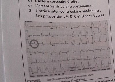 physio qcm.jpg