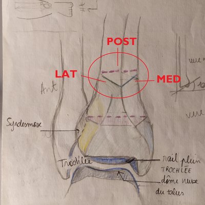 diaphyse tibia coupe.jpg