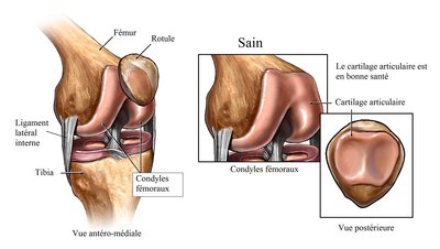 fémur-tibia-rotule-1-1.jpg