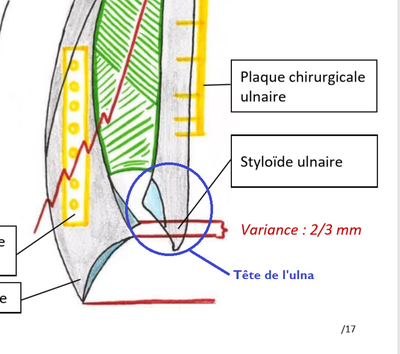 tete ulna.png