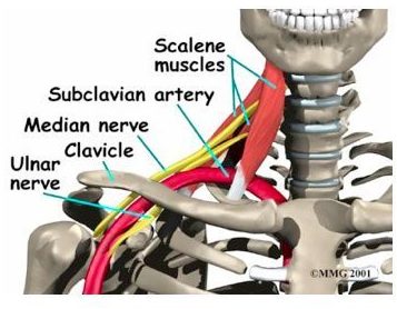 thoraco-brachial-e1498227207995.jpg