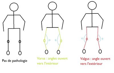 varus valgus angles.jpg