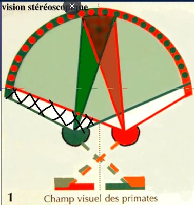 champ visuel lésion 1.jpg