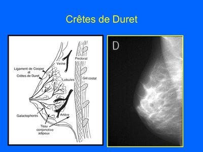 Crêtes+de+Duret.jpg