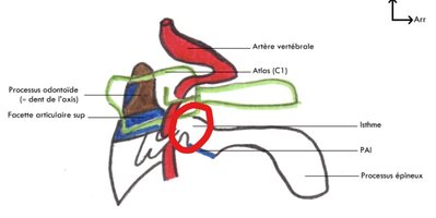 Isthme de C2.jpg